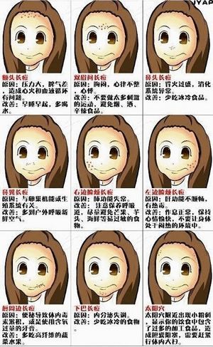 青春痘长在不同位置原因及治疗